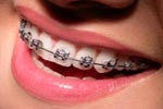 Mutuelle d'assurance pas cher - Orthodontie Mutuelle d'assurance pas cher - Orthodontie