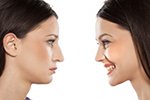 remboursement rhinoplastie